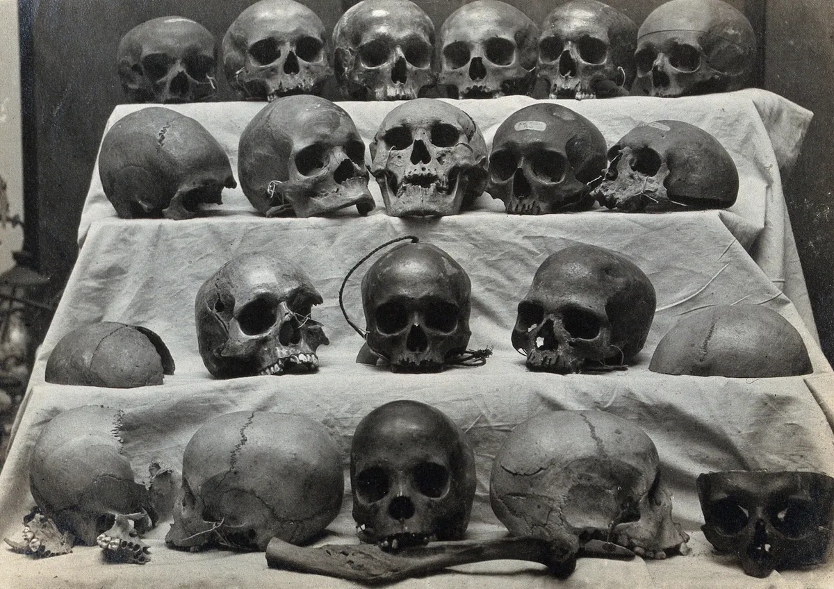 skull-l-1777689064681-17776890651261299676324-1 Các nhà khoa học phát hiện hộp sọ con người đã thay đổi rõ rệt chỉ sau 100 năm khiến giới nghiên cứu bất ngờ - Ảnh 1.