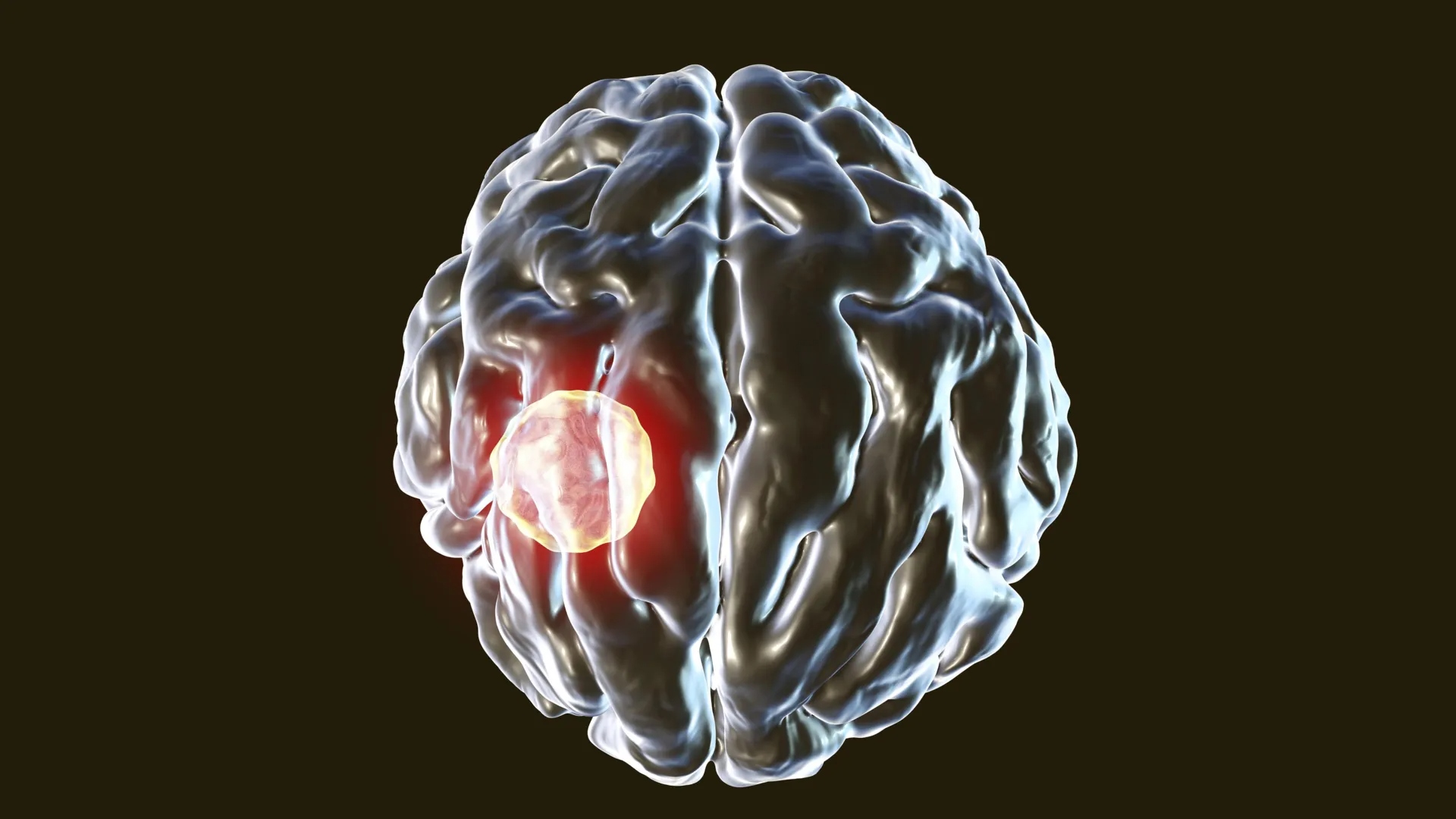 brain-abscess-caused-by-parasiti-1784261047371-1784261049860515969372